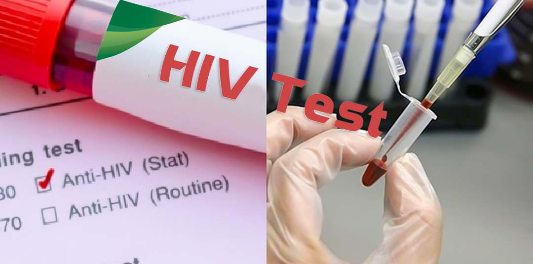 Cơ thể người nhiễm virus HIV/AIDS sẽ ngày càng yếu