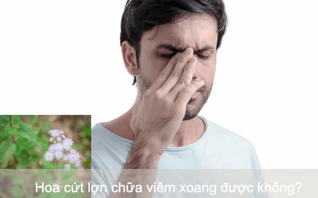 Cách chữa viêm xoang bằng hoa cứt lợn